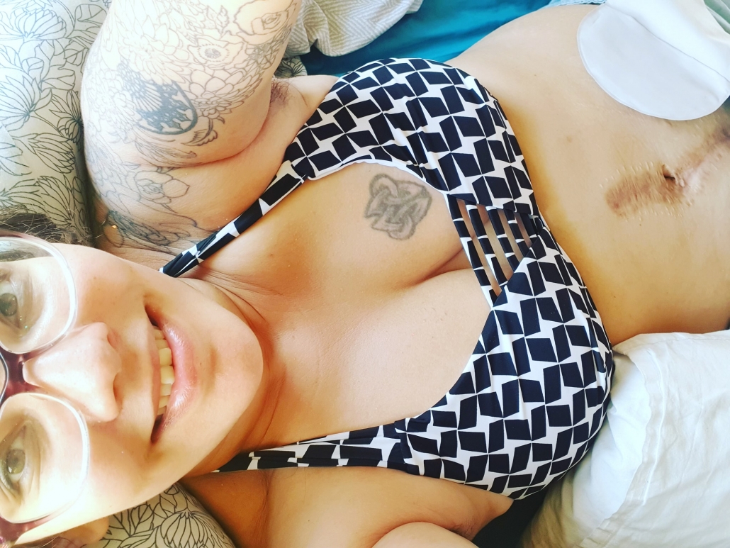 Camping with an ileostomy, festivals with a stoma chronic illness and festivals